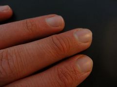 Br&uuml;chige und matte Fingern&auml;gel?