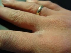 Weg mit der Winterhaut!